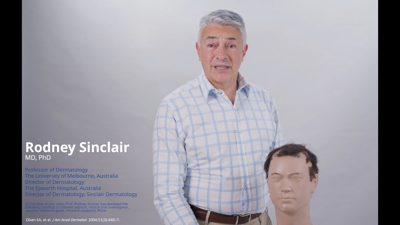 Salt Score Worksheet Let’s Talk About the Severity of Alopecia Tool (SALT) Score - YouTube