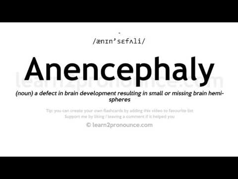 Izgovorjava anencefalija | Opredelitev Anencephaly