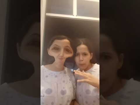 ستنو بارت تو بكرا برت 1 بلتلها شعرا كلو مي