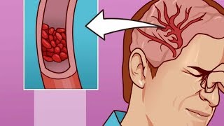 Vücudunuz D Vitamini Eksikliğiniz Olduğunu Bu 13 İşaretle Gösteriyor