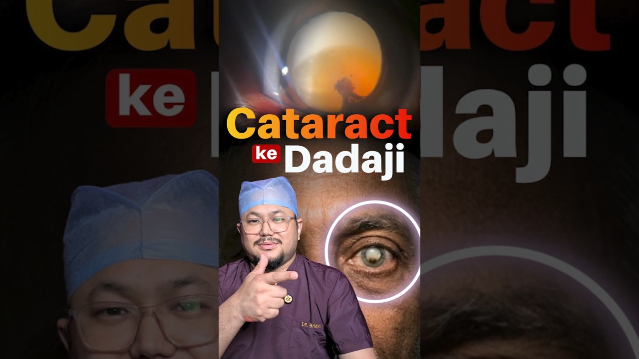 Morgagnian Cataract Explained