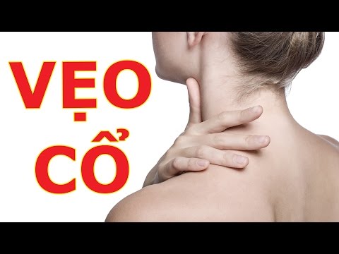 Video VẸO CỔ - LƯƠNG Y HOÀNG DUY TÂN - youtube