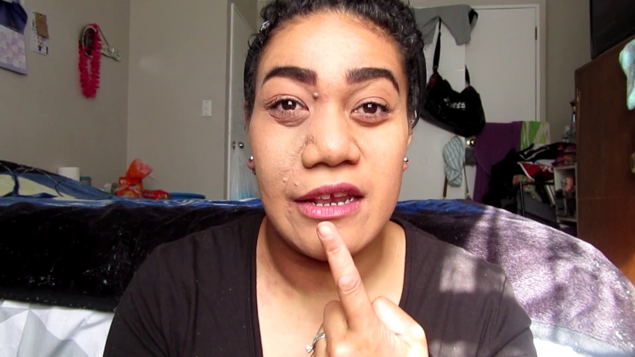 How I Cover My Birthmark