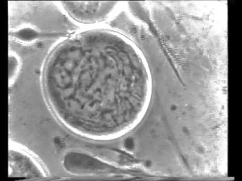Historic time lapse movie by Dr. Kurt Michel, Carl Zeiss Jena (ca. 1943)