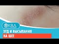 😕 Зуд и высыпания на шее. Клинический случай №404