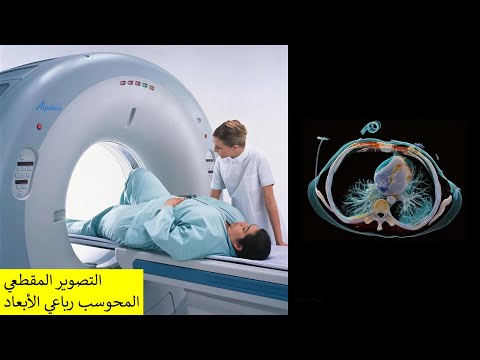 التصوير المقطعي المحوسب رباعي الأبعاد