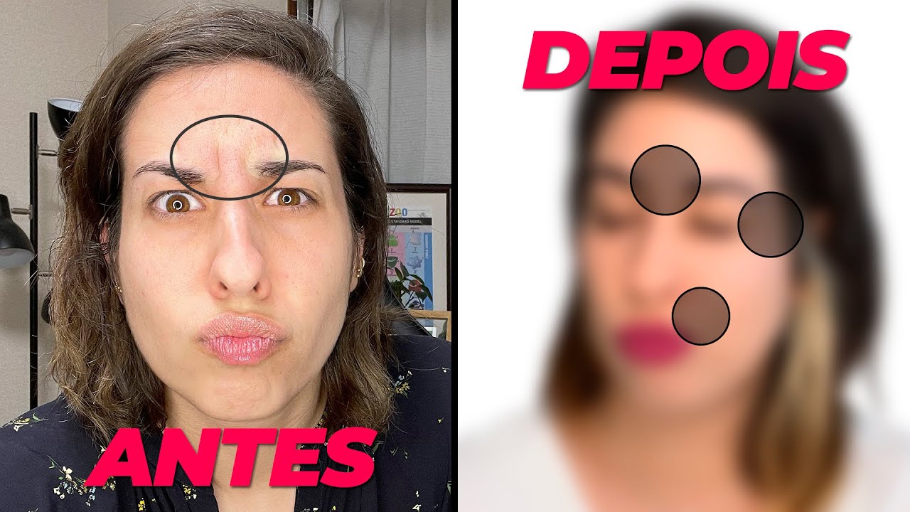 A CIÊNCIA DO BOTOX: PRÓS E CONTRAS (MEU ANTES E DEPOIS) • Física e Afins