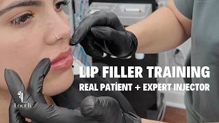 Lip Filler Masterclass | Real Patient + Injector Training with Laura Loutfi