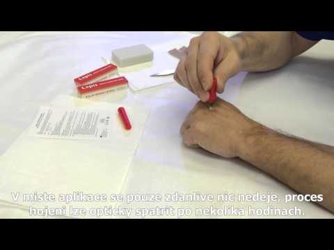 Video: Lapisova Ceruzka Z Papilómov: Návod Na Použitie, Rady Lekára