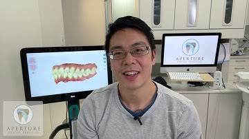 How iTero is used for Invisalign Orthodontic Treatment