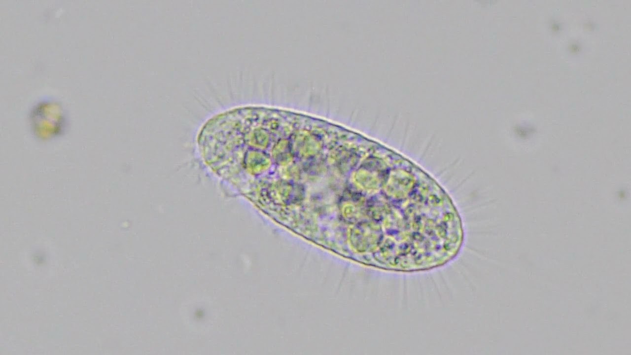 プレウロネマ Pleuronema