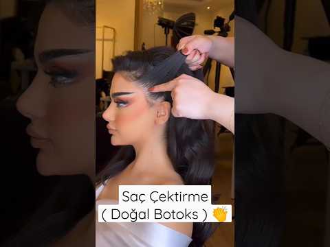 Saç Çektirme (