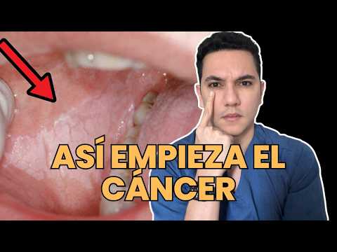 Así empieza el cáncer de piel y de boca: no ignores estas lesiones