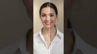 Costly cream not giving results?? Skin Booster @royalderma