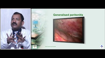 Advantages and disadvantages of minimal access surgery part   2