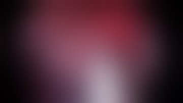 Uniportal vats right S10 segmentectomy