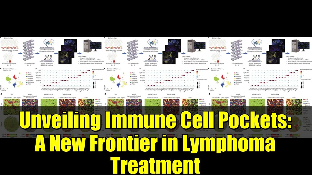 Unveiling Immune Cell Pockets: A New Frontier in Lymphoma Treatment