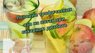 Лечение трофических язв на ногах при сахарном диабете Лечение трофических язв на ногах при сахарном диабете
