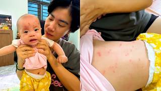 Mom Was Worried When Baby Kim Developed A Rash After Having A Fever
