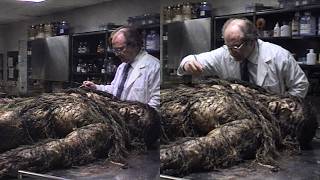 My Late Husband Donated His Body to Science — The Lab Called to Ask If I Knew He Was Part Bigfoot