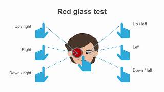 ca test ocular pentru interes