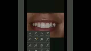 Smartphone SmileDesign - Ortho Mockup screenshot 2
