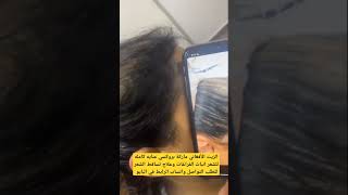 الزيت الأفغاني الأصلي | يعالج تساقط الشعر ويعمل على انبات الفراغات للطلب التواصل واتساب ??