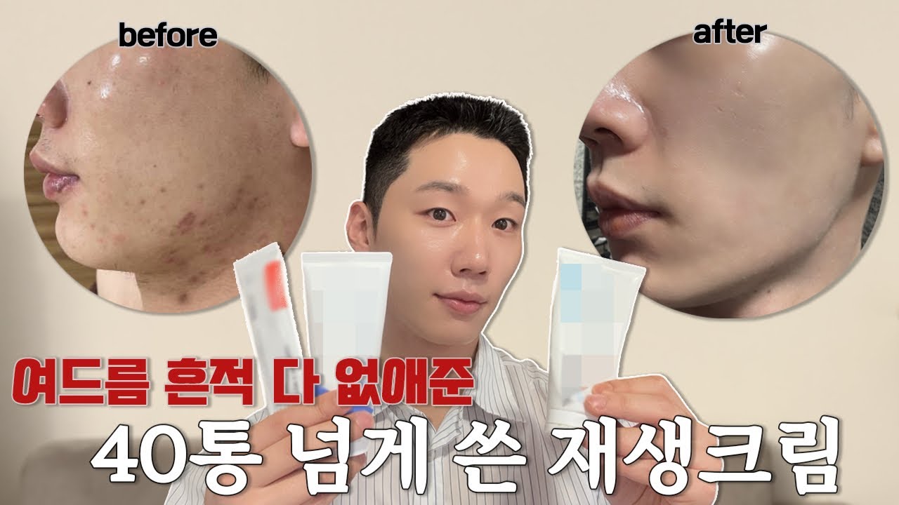 가장 효과봤던 재생크림 3가지