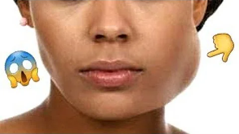 Porquê da abscesso no dente?