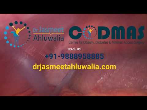 laparoscopic-surgery-in-jalandhar-|-hernia-operation-specialist-doctor-in-punjab,-india