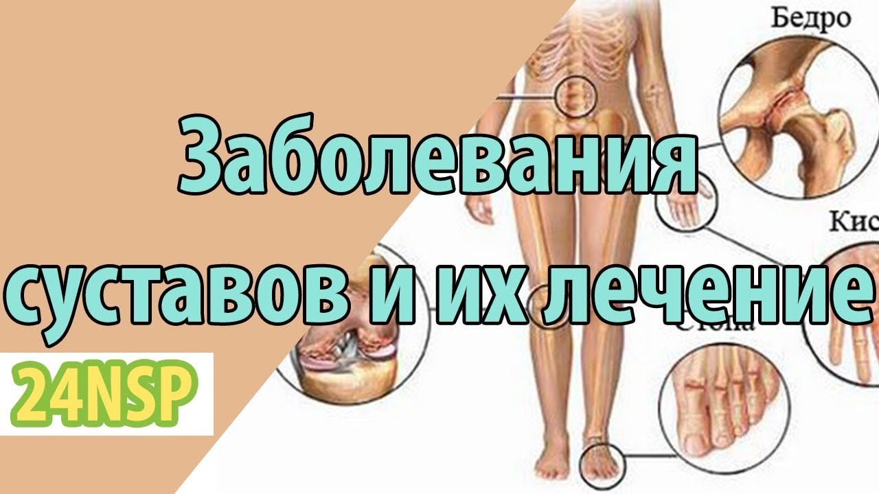 соматон крем бальзам для позвоночника мышц суставов