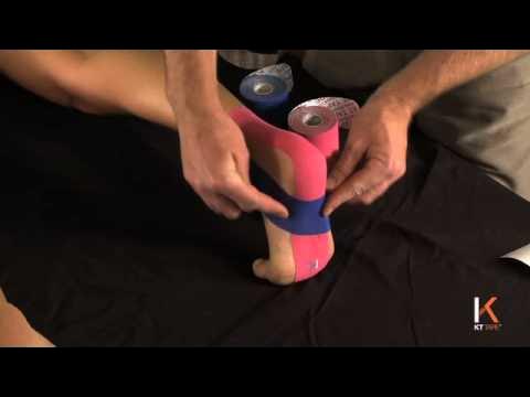 Kinesio tape actually curbs kneecap grind - Cycling after TKR