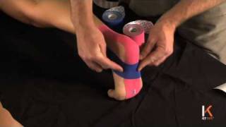 KT Tape: Plantar Fasciitis II