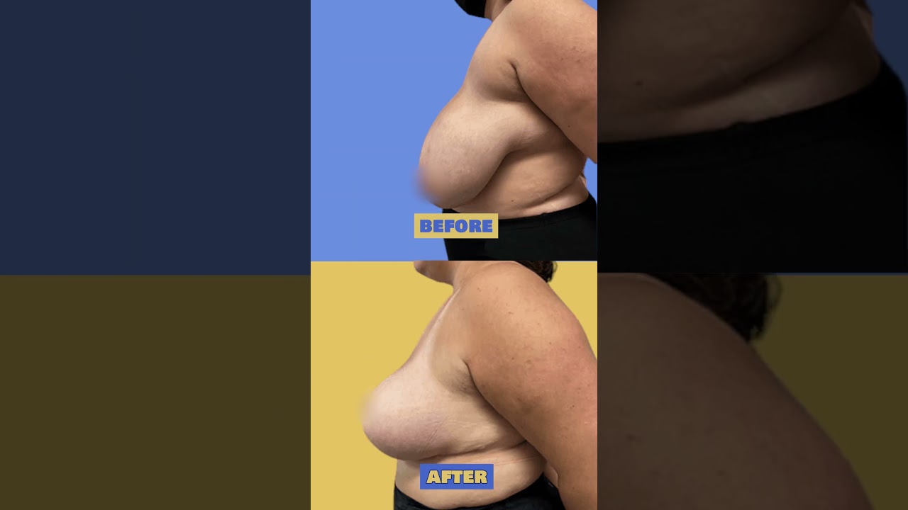 Life changing transformation for this patient!