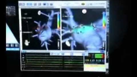 3D Image Integration and Ablation