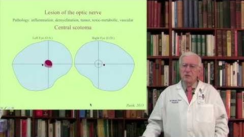 Lecture 5.  The Visual System  III-IV Structure, Function and Dysfunction