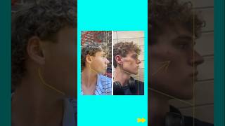 INTERORAL FACE PULLING: Before & After 🔥 #face #jawline #facepulling #thumbpulling
