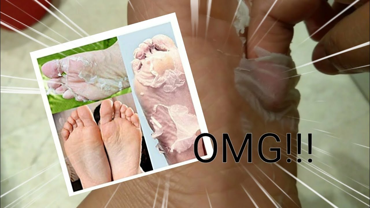 CRAZY FOOT PEELING ( SO SATISFYING) try not to vomit YouTube