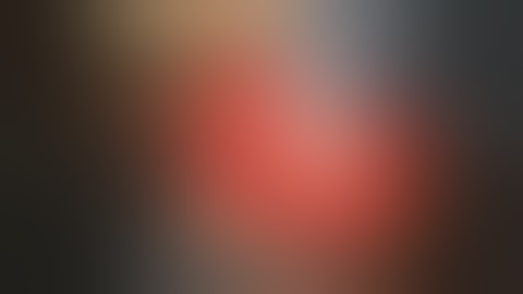 P Com Aneurysm Clipping Movie 30 june 2017