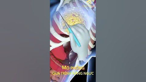 Quá Trình Nâng Ngực 3D /Bác sĩ Trọng #shots #phauthuatthammy #bacsitrong #nangvong1 #nangnguc