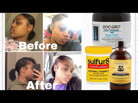Doo Gro Before And After DOO GRO, SULFUR 8, CASTOR OIL| for long & thick| Update? | #Natural #hair #growth #naturalhairstyles - YouTube