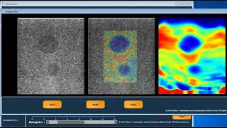 US-Elasto software for ultrasound elastography screenshot 1