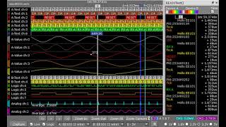 EE101 Insight Pro User Interface Tour
