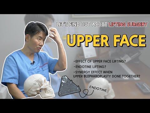 Upper Face – Brow / Forehead Lift — Hqdefault