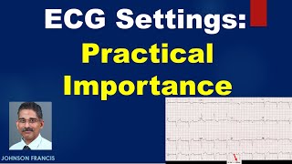 ECG Settings - Practical Importance