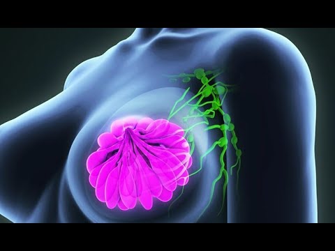 Video: Քաղցկեղի բջիջները դիֆերենցվա՞ծ են, թե՞ չտարբերակված: