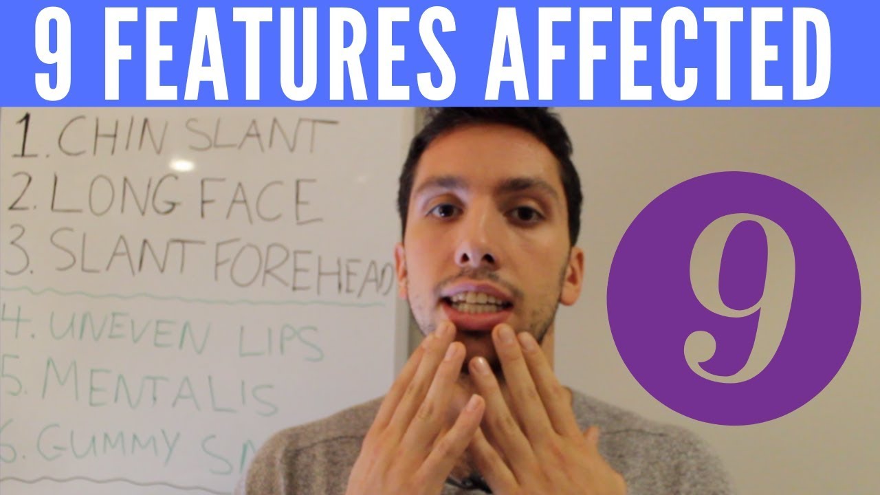 9 Facial Features Affected by Mewing (How Tongue Posture Affects Face Shape) camera iphone 8 plus apk