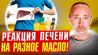 Как ПЕЧЕНЬ реагирует на МАСЛО? Вредные и полезные продукты для Печени!