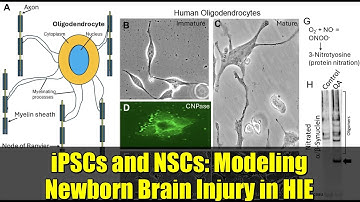 iPSCs and NSCs: Modeling Newborn Brain Injury in HIE