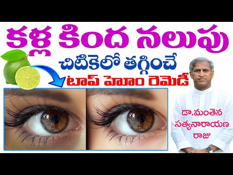 కళ్ల కింద నలుపు తగ్గి, మళ్ళీ రాకుండా | Dark Circles Under the Eyes | Dr Manthena Satyanarayana Raju